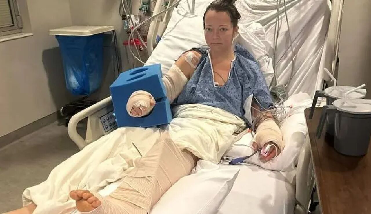 Una mujer pierde una pierna tras ser atacada por su propio pitbull 