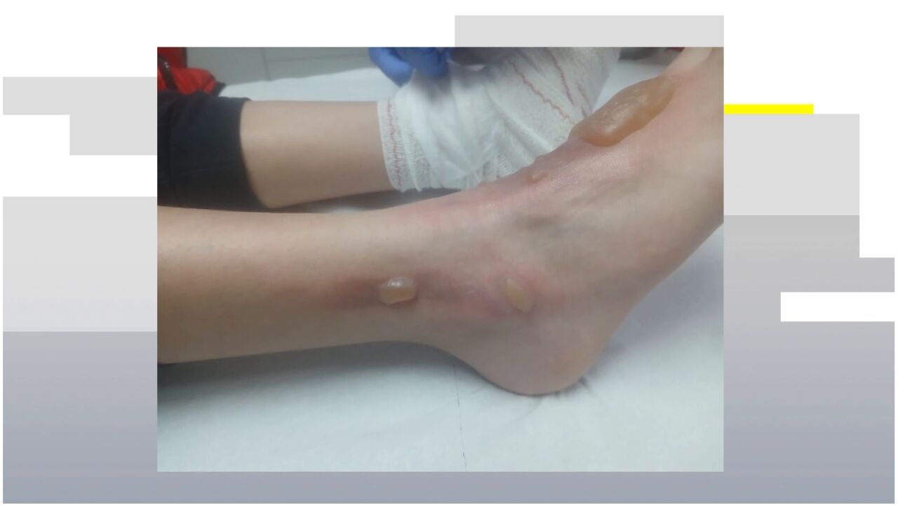 Un ni&ntilde;o, agredido por un compa&ntilde;ero en C&aacute;diz