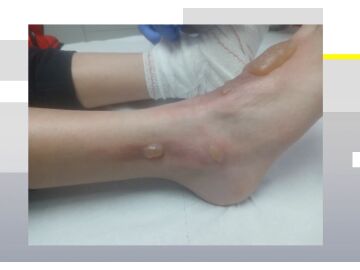 Un ni&ntilde;o, agredido por un compa&ntilde;ero en C&aacute;diz