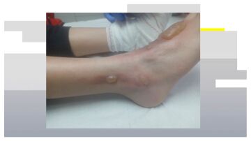 Un ni&ntilde;o, agredido por un compa&ntilde;ero en C&aacute;diz