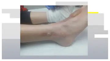 Un niño, agredido por un compañero en Cádiz Un niño, agredido por un compañero en Cádiz