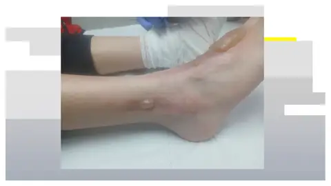 Un niño, agredido por un compañero en Cádiz Un niño, agredido por un compañero en Cádiz