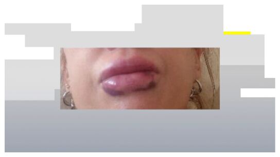 Labios 