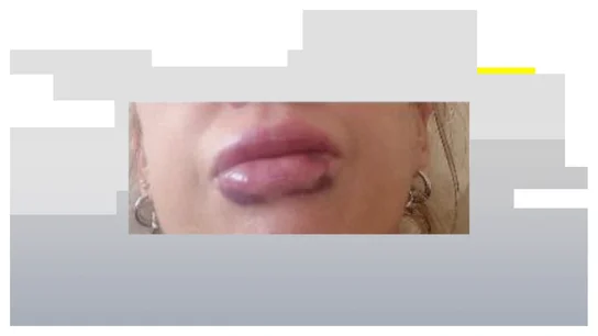 Labios Labios