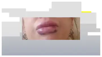 Labios Labios