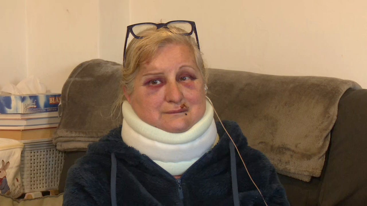 El dolor era tan tremendo que solo pensaba en mi marido El dolor era tan tremendo que solo pensaba en mi marido