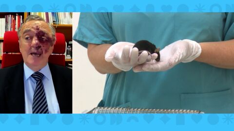 Eliminan el c&aacute;ncer de pancreas en ratones.