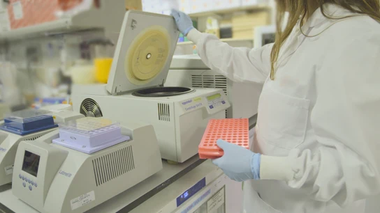 Un estudio demuestra que una triple combinación de fármacos mejora los resultados en cáncer de mama avanzado HR+/HER2+ Imagen de la investigación.REMITIDA / HANDOUT por SOLTIFotografía remitida a medios de comunicación exclusivamente para ilustrar la noticia a la que hace referencia la imagen, y citando la procedencia de la imagen en la firma03/02/2026