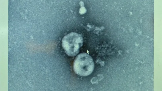 Virus papiloma humano Virus papiloma humano