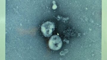 Virus papiloma humano