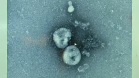 Virus papiloma humano Virus papiloma humano