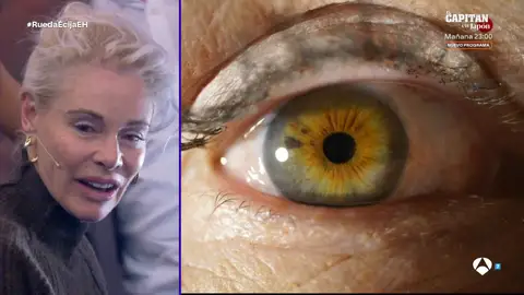 El ojo humano, convertido en arte fotográfico: Belén Rueda y Belén Écija se prestan como modelos El ojo humano, convertido en arte fotográfico: Belén Rueda y Belén Écija se prestan como modelos