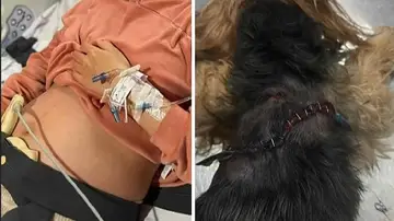 La embarazada y su perro tras el ataque La embarazada y su perro tras el ataque