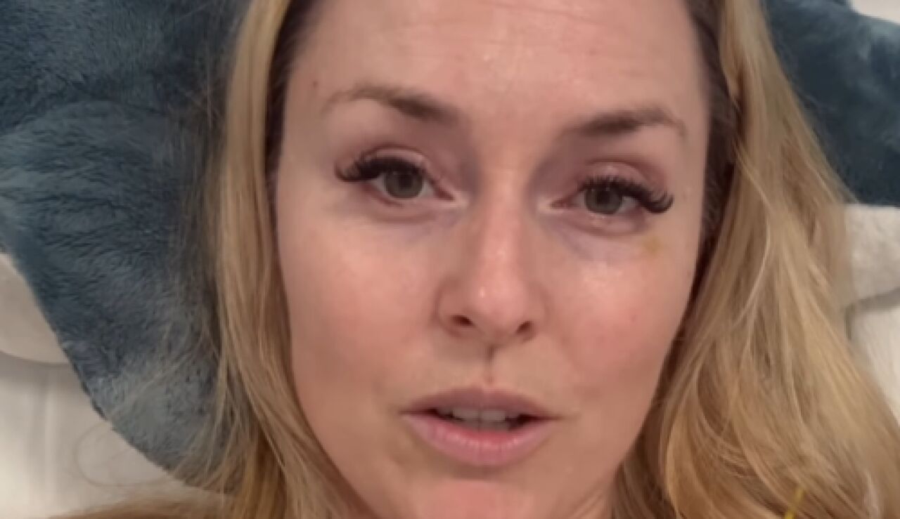 Lindsey Vonn desde el hospital 
