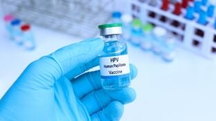 Virus del papiloma humano