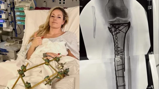 El calvario de Lindsey Vonn tras su caída en los Juegos El calvario de Lindsey Vonn tras su caída en los Juegos