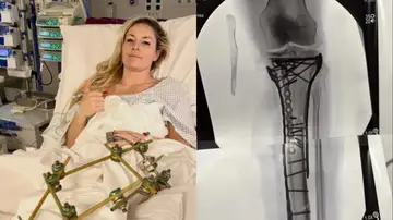 El calvario de Lindsey Vonn tras su caída en los Juegos El calvario de Lindsey Vonn tras su caída en los Juegos