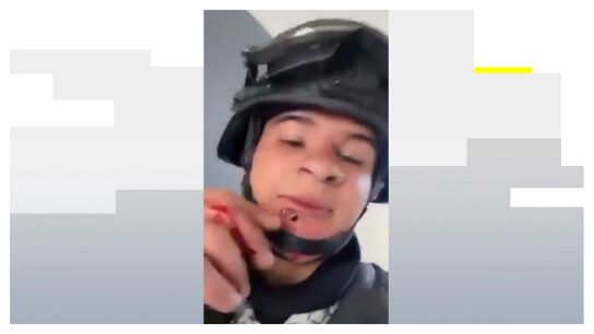 Soldado con una bala en la cara