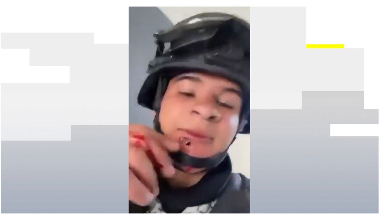 Soldado con una bala en la cara