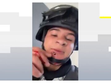 Soldado con una bala en la cara