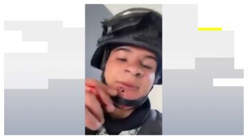 Soldado con una bala en la cara