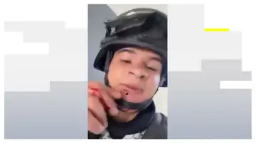 Soldado con una bala en la cara Soldado con una bala en la cara