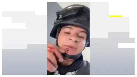 Soldado con una bala en la cara Soldado con una bala en la cara