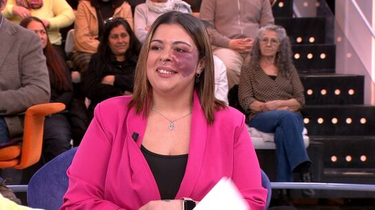 El rechazo de Daniela por sus "manchas" en la piel