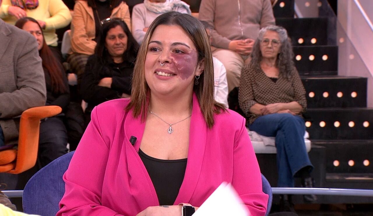 El rechazo de Daniela por sus "manchas" en la piel