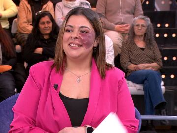 El rechazo de Daniela por sus "manchas" en la piel