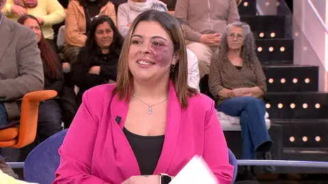 El rechazo de Daniela por sus "manchas" en la piel El rechazo de Daniela por sus "manchas" en la piel