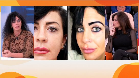 Ojos