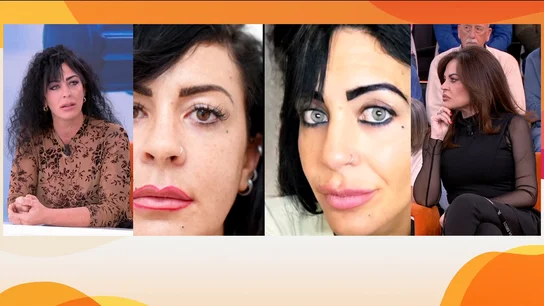 Ojos Ojos