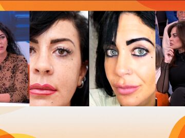 Ojos