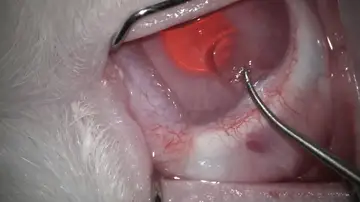 Implante de córnea con escamas de peces Implante de córnea con escamas de peces