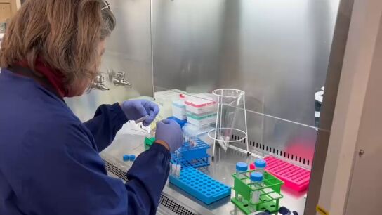Investigadores de CNAG han investigado el epicentro del cerebro para comprender c&oacute;mo evolucionan las enfermedades cerebrales