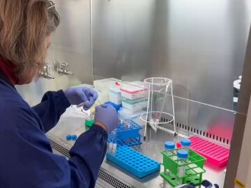 Investigadores de CNAG han investigado el epicentro del cerebro para comprender c&oacute;mo evolucionan las enfermedades cerebrales