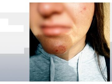 V&iacute;ctima de un posible caso de acoso escolar en M&aacute;laga