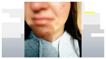 V&iacute;ctima de un posible caso de acoso escolar en M&aacute;laga