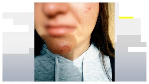 V&iacute;ctima de un posible caso de acoso escolar en M&aacute;laga