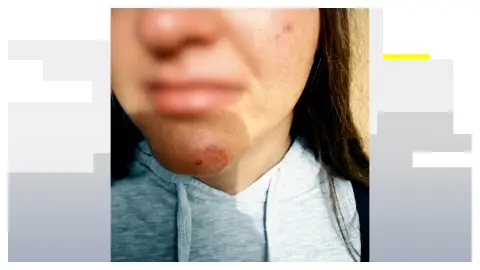 Víctima de un posible caso de acoso escolar en Málaga Víctima de un posible caso de acoso escolar en Málaga