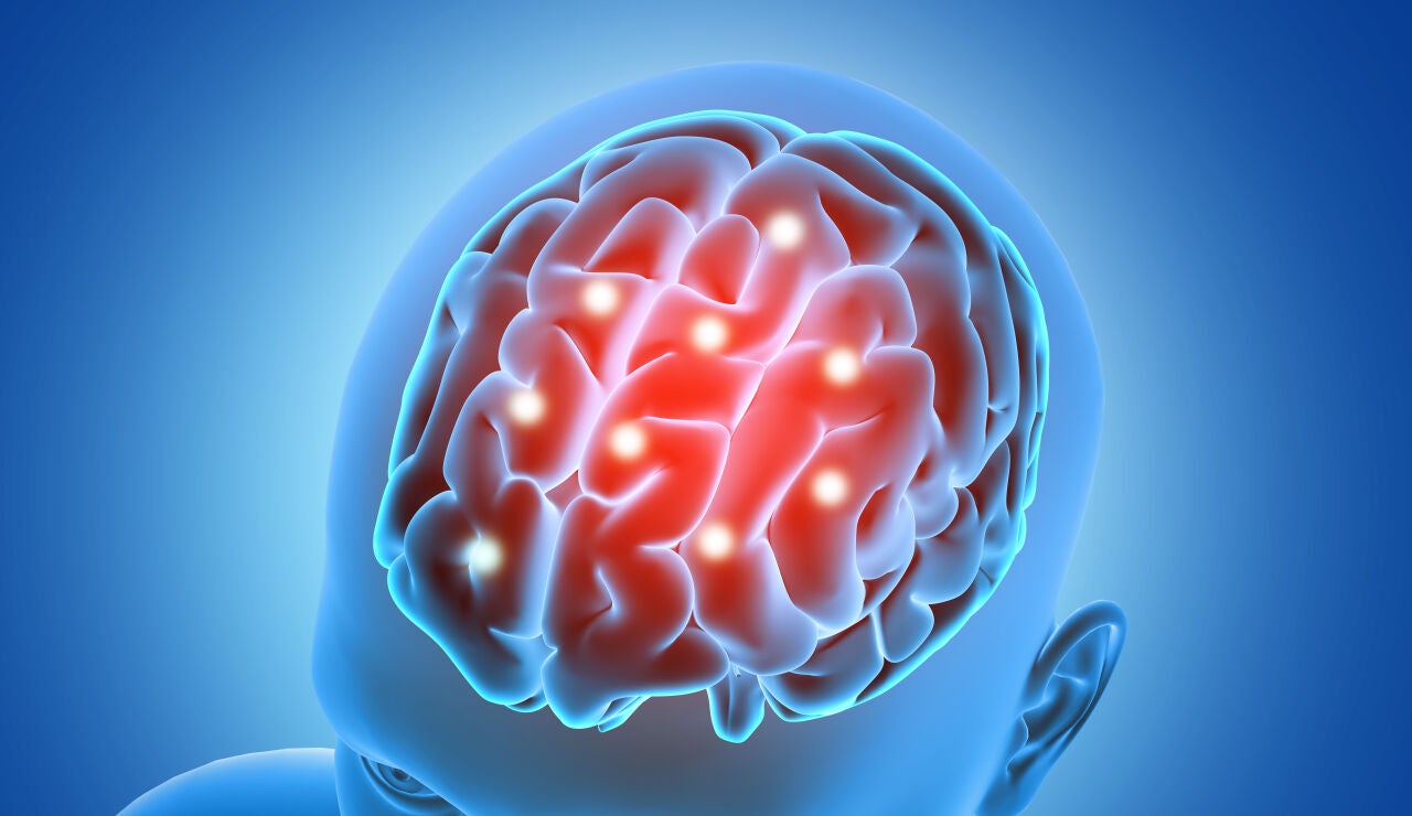 Representaci&oacute;n en 3D de un cerebro