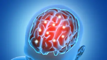 Representación en 3D de un cerebro Representación en 3D de un cerebro