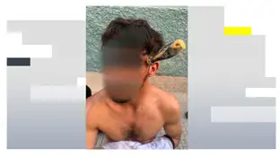 Duras imágenes: Le clavan a un joven de 25 años un destornillador en la cabeza Duras imágenes: Le clavan a un joven de 25 años un destornillador en la cabeza