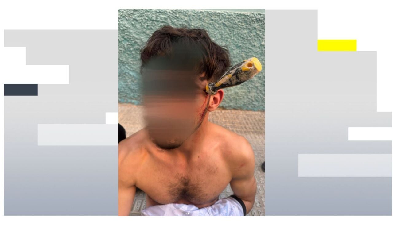 Duras im&aacute;genes: Le clavan a un joven de 25 a&ntilde;os un destornillador en la cabeza