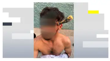 Duras imágenes: Le clavan a un joven de 25 años un destornillador en la cabeza Duras imágenes: Le clavan a un joven de 25 años un destornillador en la cabeza