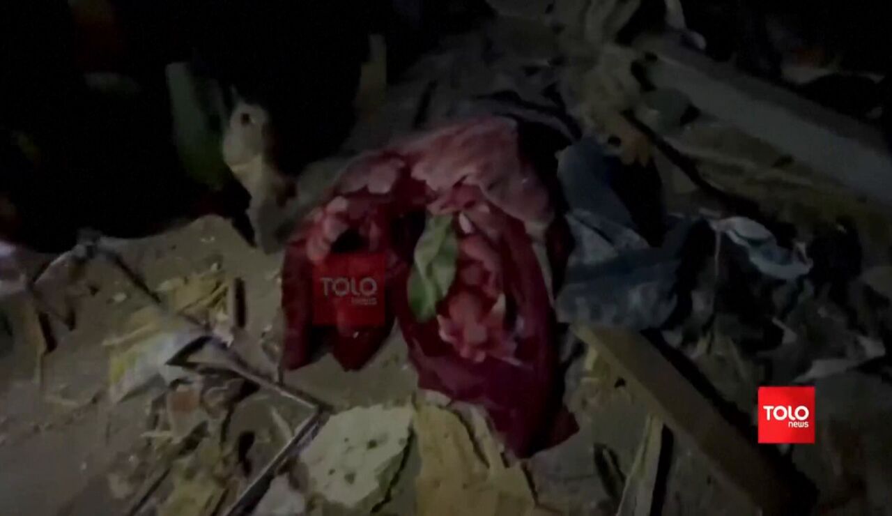 Bombardeo en un hospital de Kabul