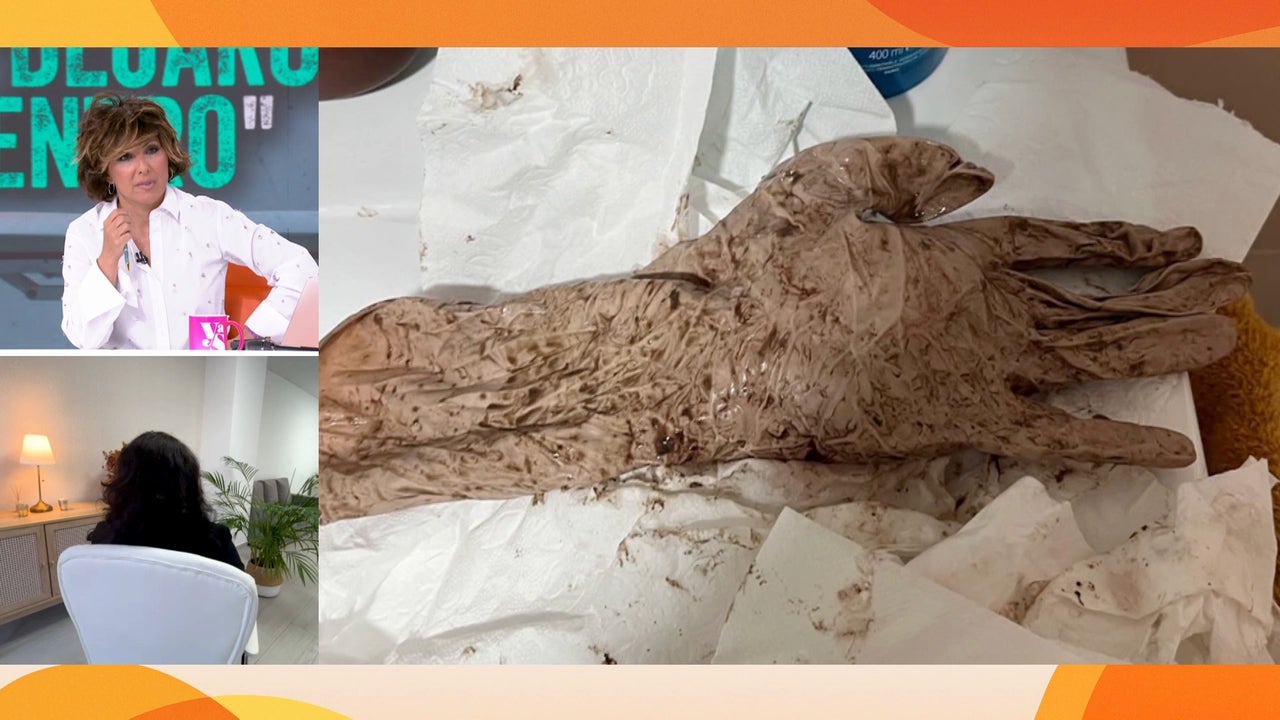 Blanca ha ‘parido’ un guante quirúrgico lleno de gasas que el médico se dejó dentro de su cuerpo: «Tenía contracciones»