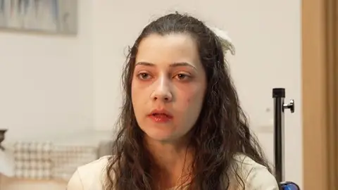 Noelia, la joven que recibirá la eutanasia esta jueves Noelia, la joven que recibirá la eutanasia esta jueves