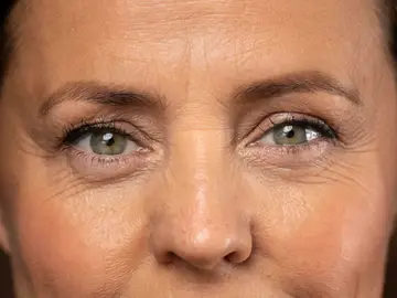 Mujer con arrugas Mujer con arrugas